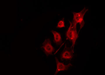 DMPK / DM Antibody - Staining HeLa cells by IF/ICC. The samples were fixed with PFA and permeabilized in 0.1% Triton X-100, then blocked in 10% serum for 45 min at 25°C. The primary antibody was diluted at 1:200 and incubated with the sample for 1 hour at 37°C. An Alexa Fluor 594 conjugated goat anti-rabbit IgG (H+L) Ab, diluted at 1/600, was used as the secondary antibody.