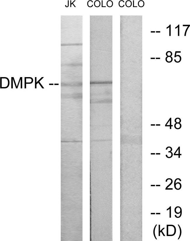 DMPK / DM Antibody - Western blot analysis of extracts from Jurkat cells and COLO205 cells, using DMPK antibody.