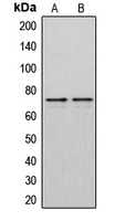 DMPK / DM Antibody - Western blot analysis of DMPK expression in HeLa (A); Jurkat (B) whole cell lysates.