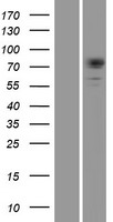 DMPK / DM Protein - Western validation with an anti-DDK antibody * L: Control HEK293 lysate R: Over-expression lysate