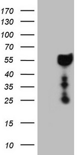 DMRT1 Antibody - HEK293T cells were transfected with the pCMV6-ENTRY control. (Left lane) or pCMV6-ENTRY DMRT1. (Right lane) cDNA for 48 hrs and lysed. Equivalent amounts of cell lysates. (5 ug per lane) were separated by SDS-PAGE and immunoblotted with anti-DMRT1. (1:2000)