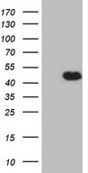 DMRT1 Antibody - HEK293T cells were transfected with the pCMV6-ENTRY control. (Left lane) or pCMV6-ENTRY DMRT1. (Right lane) cDNA for 48 hrs and lysed. Equivalent amounts of cell lysates. (5 ug per lane) were separated by SDS-PAGE and immunoblotted with anti-DMRT1. (1:500)