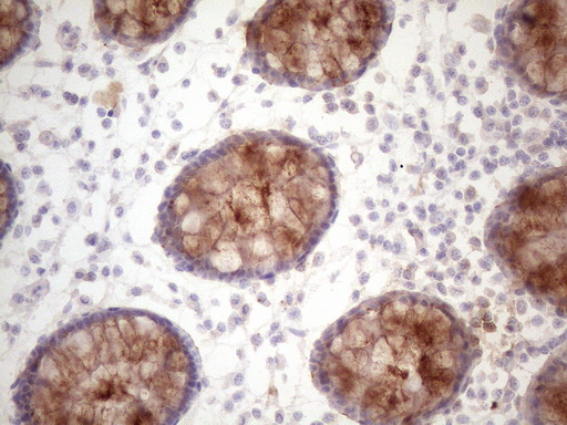 DMRT1 Antibody - Immunohistochemical staining of paraffin-embedded Human colon tissue within the normal limits using anti-DMRT1 mouse monoclonal antibody. (Heat-induced epitope retrieval by 1 mM EDTA in 10mM Tris, pH8.5, 120C for 3min. (1:150)