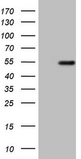 DMRT1 Antibody - HEK293T cells were transfected with the pCMV6-ENTRY control (Left lane) or pCMV6-ENTRY DMRT1 (Right lane) cDNA for 48 hrs and lysed. Equivalent amounts of cell lysates (5 ug per lane) were separated by SDS-PAGE and immunoblotted with anti-DMRT1 (1:2000).