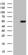 DMRT1 Antibody - HEK293T cells were transfected with the pCMV6-ENTRY control (Left lane) or pCMV6-ENTRY DMRT1 (Right lane) cDNA for 48 hrs and lysed. Equivalent amounts of cell lysates (5 ug per lane) were separated by SDS-PAGE and immunoblotted with anti-DMRT1 (1:2000).