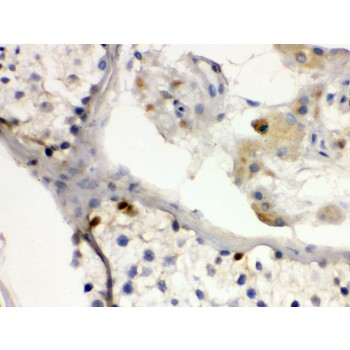 DMRT1 Antibody - DMRT1 antibody IHC-paraffin. IHC(P): Human Testis Tissue.