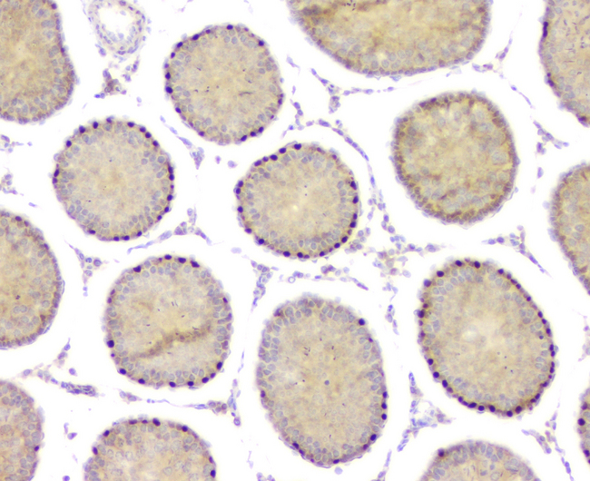 DMRT1 Antibody - IHC analysis of DMRT1 using anti-DMRT1 antibody. DMRT1 was detected in paraffin-embedded section of rat testis tissue. Heat mediated antigen retrieval was performed in citrate buffer (pH6, epitope retrieval solution) for 20 mins. The tissue section was blocked with 10% goat serum. The tissue section was then incubated with 1µg/ml rabbit anti-DMRT1 Antibody overnight at 4°C. Biotinylated goat anti-rabbit IgG was used as secondary antibody and incubated for 30 minutes at 37°C. The tissue section was developed using Strepavidin-Biotin-Complex (SABC) with DAB as the chromogen.
