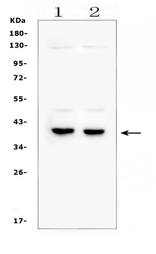 DMRT1 Antibody - Western blot analysis of DMRT1 using anti-DMRT1 antibody. Electrophoresis was performed on a 5-20% SDS-PAGE gel at 70V (Stacking gel) / 90V (Resolving gel) for 2-3 hours. The sample well of each lane was loaded with 50ug of sample under reducing conditions. Lane 1: rat testis tissue lysates,Lane 2: mouse testis tissue lysates. After Electrophoresis, proteins were transferred to a Nitrocellulose membrane at 150mA for 50-90 minutes. Blocked the membrane with 5% Non-fat Milk/ TBS for 1.5 hour at RT. The membrane was incubated with rabbit anti-DMRT1 antigen affinity purified polyclonal antibody at 0.5 µg/mL overnight at 4°C, then washed with TBS-0.1% Tween 3 times with 5 minutes each and probed with a goat anti-rabbit IgG-HRP secondary antibody at a dilution of 1:10000 for 1.5 hour at RT. The signal is developed using an Enhanced Chemiluminescent detection (ECL) kit with Tanon 5200 system. A specific band was detected for DMRT1 at approximately 39KD. The expected band size for DMRT1 is at 39KD.