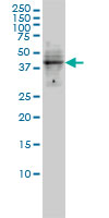 DMRT1 Antibody - DMRT1 monoclonal antibody (M01), clone 1G11 Western Blot analysis of DMRT1 expression in HL-60.