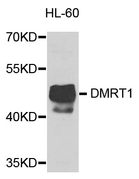 DMRT1 Antibody - Western blot analysis of extracts of HL-60 cells.