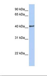 DMRT1 Antibody - Fetal brain lysate. Antibody concentration: 1.0 ug/ml. Gel concentration: 12%.  This image was taken for the unconjugated form of this product. Other forms have not been tested.