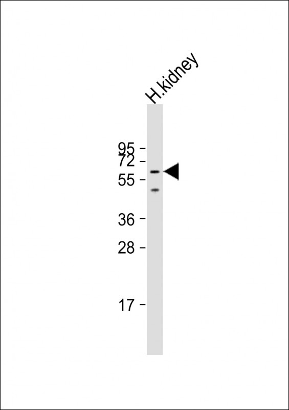 DMRT2 Antibody - Anti-DMRT2 Antibody (N-Term) at 1:2000 dilution + human kidney lysate Lysates/proteins at 20 ug per lane. Secondary Goat Anti-Rabbit IgG, (H+L), Peroxidase conjugated at 1:10000 dilution. Predicted band size: 62 kDa. Blocking/Dilution buffer: 5% NFDM/TBST.