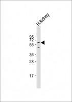 DMRT2 Antibody - Anti-DMRT2 Antibody (N-Term) at 1:2000 dilution + human kidney lysate Lysates/proteins at 20 ug per lane. Secondary Goat Anti-Rabbit IgG, (H+L), Peroxidase conjugated at 1:10000 dilution. Predicted band size: 62 kDa. Blocking/Dilution buffer: 5% NFDM/TBST.