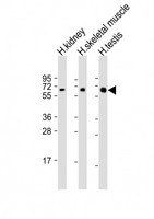 DMRT2 Antibody - All lanes: Anti-DMRT2 Antibody (Center) at 1:2000 dilution. Lane 1: human kidney lysate. Lane 2: human skeletal muscle lysate. Lane 3: human testis lysate Lysates/proteins at 20 ug per lane. Secondary Goat Anti-Rabbit IgG, (H+L), Peroxidase conjugated at 1:10000 dilution. Predicted band size: 62 kDa. Blocking/Dilution buffer: 5% NFDM/TBST.