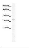 DMRT2 Antibody - SP2/0 Cell Lysate.  This image was taken for the unconjugated form of this product. Other forms have not been tested.