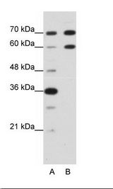 DMRT2 Antibody - A: Marker, B: HepG2 Cell Lysate.  This image was taken for the unconjugated form of this product. Other forms have not been tested.