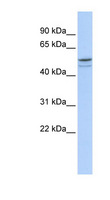 DMRTA1 Antibody - DMRTA1 antibody Western blot of HeLa lysate. This image was taken for the unconjugated form of this product. Other forms have not been tested.