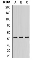 DMRTA1 Antibody - Western blot analysis of DMRTA1 expression in HEK293T (A); Raw264.7 (B); PC12 (C) whole cell lysates.