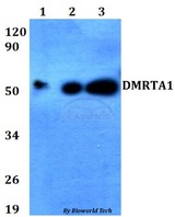 DMRTA1 Antibody - Western blot of DMRTA1 antibody at 1:500 dilution. Lane 1: HEK293T whole cell lysate. Lane 2: Raw264.7 whole cell lysate. Lane 3: PC12 whole cell lysate.