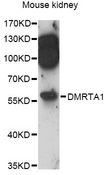 DMRTA1 Antibody - Western blot analysis of extracts of mouse kidney, using DMRTA1 antibody at 1:3000 dilution. The secondary antibody used was an HRP Goat Anti-Rabbit IgG (H+L) at 1:10000 dilution. Lysates were loaded 25ug per lane and 3% nonfat dry milk in TBST was used for blocking. An ECL Kit was used for detection and the exposure time was 90s.