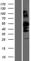 DMRTA1 Protein - Western validation with an anti-DDK antibody * L: Control HEK293 lysate R: Over-expression lysate