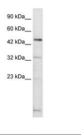 DMRTA2 Antibody - Jurkat Cell Lysate.  This image was taken for the unconjugated form of this product. Other forms have not been tested.