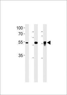 DMRTA2 Antibody - DMRTA2 Antibody western blot of PC-3 cell line, mouse testis and zebra fish brain tissue lysates (35 ug/lane). The DMRTA2 antibody detected the DMRTA2 protein (arrow).