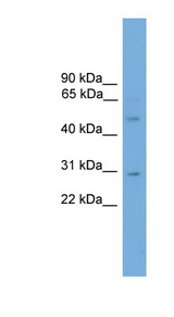 DMRTA3 / DMRT3 Antibody - DMRT3 antibody Western blot of Mouse Kidney lysate. This image was taken for the unconjugated form of this product. Other forms have not been tested.