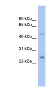 DMRTA3 / DMRT3 Antibody - DMRT3 antibody Western blot of PANC1 cell lysate. This image was taken for the unconjugated form of this product. Other forms have not been tested.