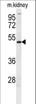 DMRTA3 / DMRT3 Antibody - DMRT3 Antibody western blot of mouse kidney tissue lysates (35 ug/lane). The DMRT3 antibody detected the DMRT3 protein (arrow).
