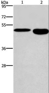 DMRTA3 / DMRT3 Antibody - Western blot analysis of Mouse stomach and brain tissue, using DMRT3 Polyclonal Antibody at dilution of 1:550.