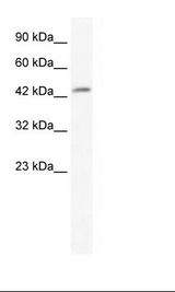 DMRTB1 Antibody - Jurkat Cell Lysate.  This image was taken for the unconjugated form of this product. Other forms have not been tested.