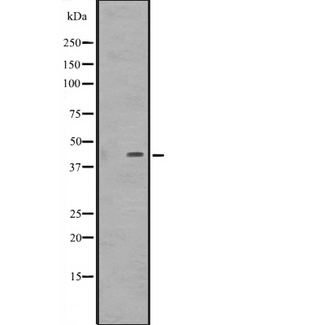 DMRTB1 Antibody - Western blot analysis of DMRTB1 expression in Jurkat cells lysate.. The lane on the left is treated with the antigen-specific peptide.