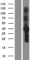 DMRTB1 Protein - Western validation with an anti-DDK antibody * L: Control HEK293 lysate R: Over-expression lysate