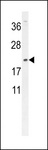 DMRTC1 Antibody - DMRTC1 Antibody western blot of MDA-MB231 cell line lysates (35 ug/lane). The DMRTC1 antibody detected the DMRTC1 protein (arrow).