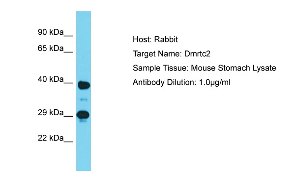 DMRTC2 Antibody -  This image was taken for the unconjugated form of this product. Other forms have not been tested.