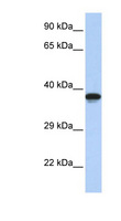 DMRTC2 Antibody - DMRTC2 antibody Western blot of Jurkat lysate. This image was taken for the unconjugated form of this product. Other forms have not been tested.