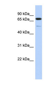 DMTF1 Antibody - DMTF1 antibody Western blot of HT1080 cell lysate. This image was taken for the unconjugated form of this product. Other forms have not been tested.