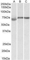 DMTF1 Antibody - DMTF1 antibody (1 ug/ml) staining of Human (A), Mouse (B) and Rat (C) Testis lysate (35 ug protein in RIPA buffer). Primary incubation was 1 hour. Detected by chemiluminescence.