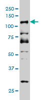 DMTF1 Antibody - DMTF1 monoclonal antibody (M03), clone 5C6 Western blot of DMTF1 expression in HeLa NE.
