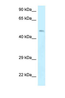 DMTN / Dematin Antibody - EPB49 / Dematin antibody Western blot of Jurkat Cell lysate. Antibody concentration 1 ug/ml.  This image was taken for the unconjugated form of this product. Other forms have not been tested.