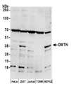 DMTN / Dematin Antibody - Detection of human and mouse DMTN by western blot. Samples: Whole cell lysate (50 µg) from HeLa, HEK293T, Jurkat, mouse TCMK-1, and Hep-G2 cells prepared using NETN lysis buffer. Antibody: Affinity purified rabbit anti-DMTN antibody used for WB at 0.1 µg/ml. Detection: Chemiluminescence with an exposure time of 75 seconds.