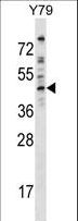 DMTN / Dematin Antibody - EPB49 Antibody western blot of Y79 cell line lysates (35 ug/lane). The EPB49 antibody detected the EPB49 protein (arrow).