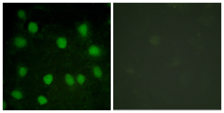 DMTN / Dematin Antibody - Immunofluorescence analysis of HUVEC cells, using Dematin Antibody. The picture on the right is blocked with the synthesized peptide.