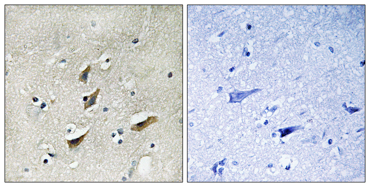 DMTN / Dematin Antibody - Immunohistochemistry analysis of paraffin-embedded human brain tissue, using Dematin Antibody. The picture on the right is blocked with the synthesized peptide.
