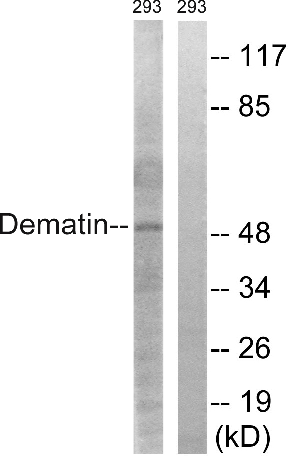 DMTN / Dematin Antibody - Western blot analysis of lysates from 293 cells, using Dematin Antibody. The lane on the right is blocked with the synthesized peptide.