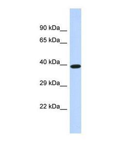 DMTN / Dematin Antibody - Western blot of Human HeLa. DMTN antibody dilution 1.0 ug/ml.  This image was taken for the unconjugated form of this product. Other forms have not been tested.