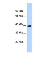 DMTN / Dematin Antibody - Western blot of Human HeLa. DMTN antibody dilution 1.0 ug/ml.  This image was taken for the unconjugated form of this product. Other forms have not been tested.