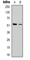DMTN / Dematin Antibody - Western blot analysis of Dematin expression in Jurkat (A); HEK293T (B) whole cell lysates.