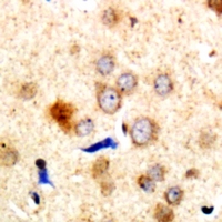 DMTN / Dematin Antibody - Immunohistochemical analysis of Dematin staining in human brain formalin fixed paraffin embedded tissue section. The section was pre-treated using heat mediated antigen retrieval with sodium citrate buffer (pH 6.0). The section was then incubated with the antibody at room temperature and detected with HRP and DAB as chromogen. The section was then counterstained with hematoxylin and mounted with DPX.
